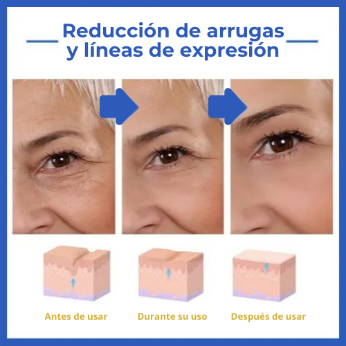 Botox Stock Solution Suero Antiarrugas