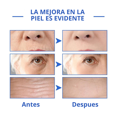 Botox Stock Solution Suero Antiarrugas
